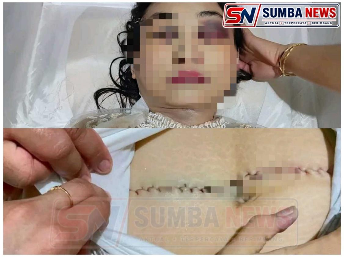 Keluarga Tolak Dugaan Bunuh Diri, Desak Pengusutan Transparan atas Kematian Winda Lorenzo Gowasa